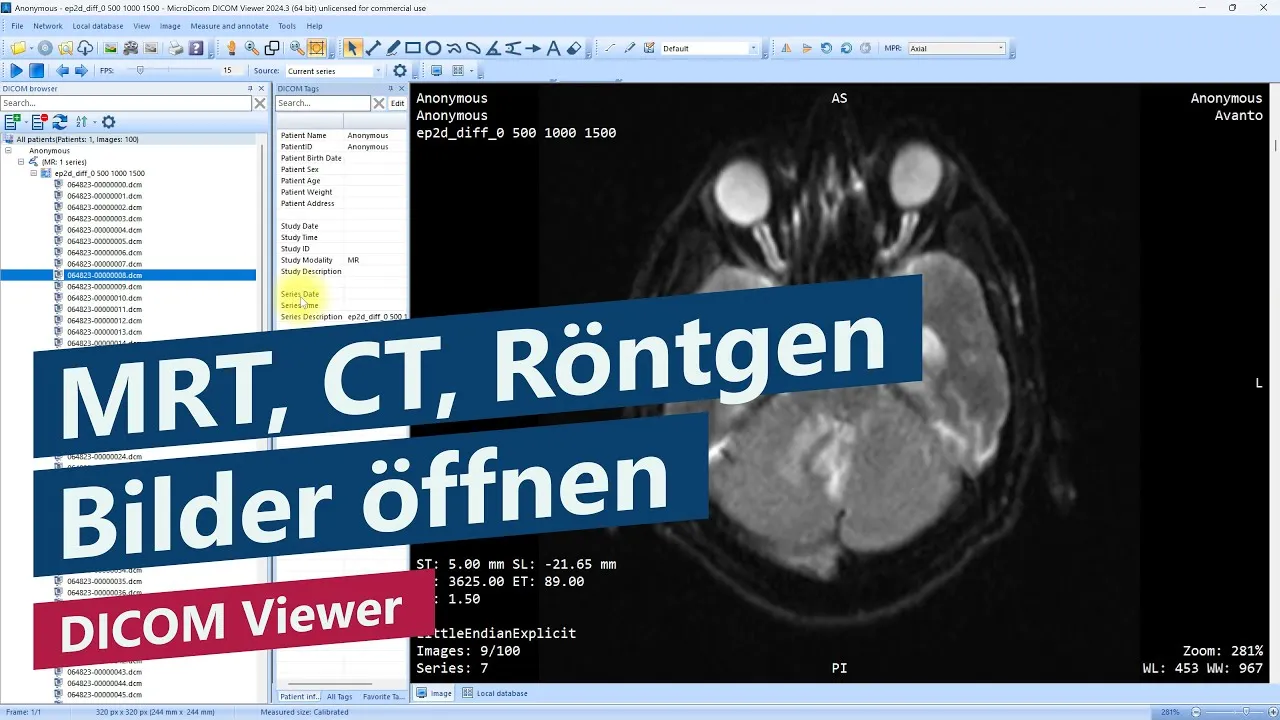 MRT-, CT- und Röntgen-Bilder öffnen (DICOM-Fotos in Windows ansehen) – Tutorial, Programmvorstellung